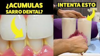 ¿Acumulas mucho sarro dental Evítalo así Te lo explico rápido y fácil [upl. by Swope643]