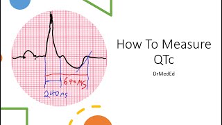 How to measure QTc CORRECTLY [upl. by Lady]