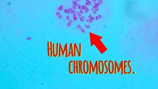 Human Chromosomes In Microscope shorts like comment [upl. by Vashtia]