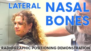 Lateral Nasal Bones Radiographic Positioning Demonstration [upl. by Parker]