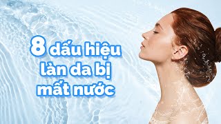 8 Dấu Hiệu Làn Da Bị Mất Nước Bạn Không Thể Bỏ Qua [upl. by Mame]