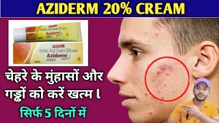 Aziderm 20 cream use dose benefits and side effects full review in hindi [upl. by Korwin722]