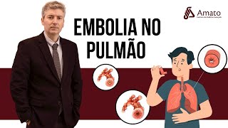 Embolia Pulmonar Aguda como evitar essa catástrofe [upl. by Kindig]