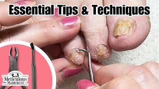 Easy Pedicure Tutorial Dementia Foot amp Nail Care Pedicure nails satisfying [upl. by Westhead]