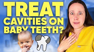 Do you have to treat cavities in baby teeth [upl. by Eanal]