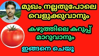 മുഖം നല്ലതുപോലെ വെളുക്കാനും  കഴുത്തിലെ കറുപ്പ് മാറാനും  ഇങ്ങനെ ചെയൂ  Face Whitening [upl. by Aig]