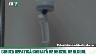 Ciroza hepatica  cauze simptome tratament [upl. by Neeoma]