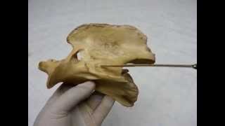 Cervical vertebrae by dr khaled shoghy [upl. by Chil]