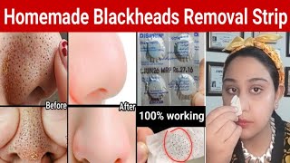 How To Remove BLACKHEADS Permanently From Nose amp Face Instantly 💯 Naturally At Home  No Whiteheads [upl. by Salokkin204]