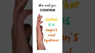 Confirmatory test for Guyon’s canal syndrome Froment’s test Ulnar tunnel syndrome shorts [upl. by Alauqahs]