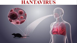 Hantavirus  Cause Transmission Symptoms Diagnosis amp Prevention Of Hantavirus Infection [upl. by Karon]