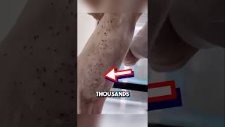 Extremely satisfying bug removal 😱 shorts oddlysatisfying [upl. by Kynthia]