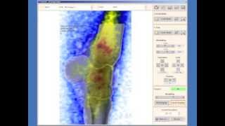 Equine Scintigraphy  Image Fusion of NM and XRay [upl. by Ogu]