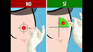 Forma correcta Para inyectar IM gluteo o nalga [upl. by Sally75]