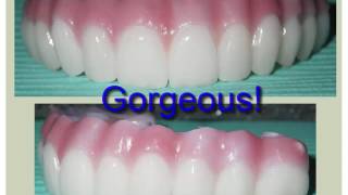 All on 4 Dental Implants and Zirconium Fixed Denture by Dr Bruce Kanehl [upl. by Ardnael]