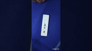 Malaria test in emergency ward emergency duty hospital nursing doctor subscribe mbbs [upl. by Ailssa]