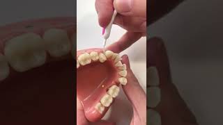 Using an Interdental Brush 2 [upl. by Hampton]