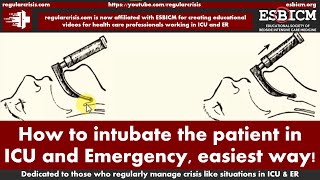 How to intubate the patient in ICU and Emergency easiest way  RegularCrisis [upl. by Sialac]