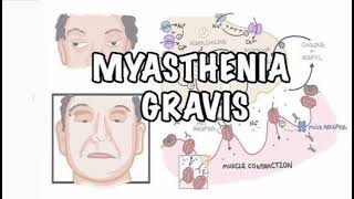 Myasthenia gravis History mrcpch Clinical [upl. by Chemaram]