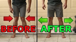 5 Ways To Fix Knocked Knees  Tight Inner Thighs [upl. by Archy]