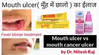 मुँह में छालो का ईलाजFever blister vs Mouth ulcerMouth ulcer vs mouth cancer ulcer by Drniteshraj [upl. by Sinclair]