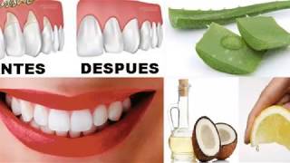 Dile Adiós a la Gingivitis de forma natural con estos 6 remedios caseros [upl. by Laeria]