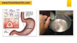 DIETA PARA HELICOBACTER PYLORI [upl. by Nahsor580]