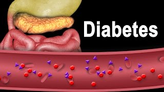 Diabetes Type 1 and Type 2 Animation [upl. by Madanhoj]