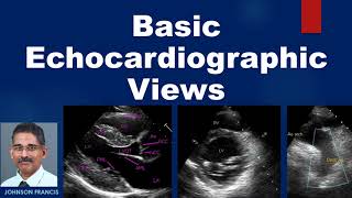 Basic Echocardiographic Views [upl. by Alyehs]