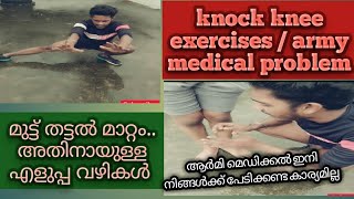 Knock knee army medical problem knock knee correction exercise മുട്ട് തട്ടൽ മാറ്റം [upl. by Ellenahs]