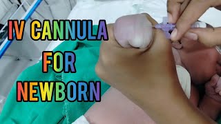 How To Insert Iv CanulaJelco  Iv Cannulation procedure  Iv Cannulation For Newborn  viralvideo [upl. by Novah]