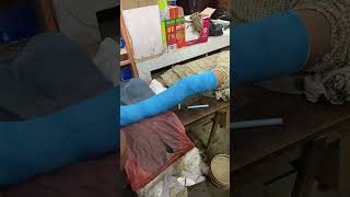 Fiber plaster  full video AR Medical Gyan is live [upl. by Eillek]