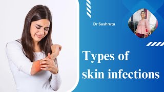 Types of skin infections  Patient education I MIC [upl. by Sandstrom950]