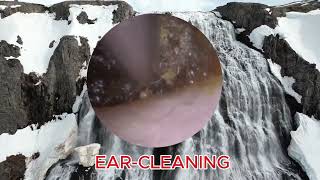 Blocked Ear Removal Extraction by Ear Wax Removal EARCLEANING [upl. by Eraste]