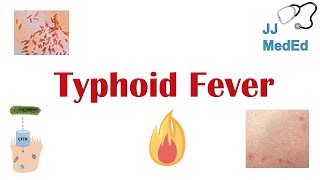 Typhoid Fever Pathogenesis vectors bacteria Symptoms Diagnosis Treatment Vaccine [upl. by Sonahpets]