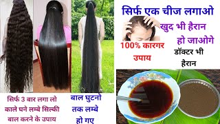 सिर्फ एक चीज के इस्तेमाल से बालों को बढ़ता हुआ देखकर आप भी हैरान हो जाएंगे  Hair Growth Remedy😱 [upl. by Aehsat]