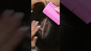 ASMR Relaxing LICE Check Removal and TREATMENT Real Person shorts short asmr [upl. by Yunfei221]