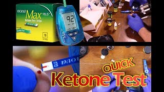 NOVA MAX Plus Glucose and Ketone Meter Tests Fully Review [upl. by Arracot]