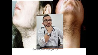 أحسن علاج لزيادة الشعر عند المرأة le meilleur traitement pour lhyperpilosité [upl. by Mamie254]