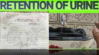 Retention of urine  Retention of urine in hindi  Retention of urine in urinary bladder [upl. by Colb]