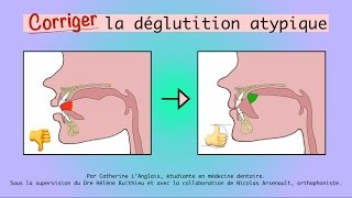 Corriger la déglutition atypique [upl. by Cleasta]