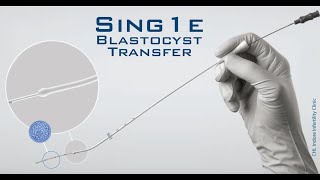 Embryo Transfer  Ultrasound Guided Embryo Transfer During ET  Embryo loading amp transferring [upl. by Eiramac998]