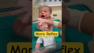 Moro reflex in newborn babyviral [upl. by Wilcox22]