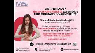 No Incisions Needed Hysterectomy VS UFE for Fibroids [upl. by Africah976]