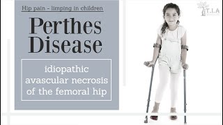 Perthes Disease LeggCalvePerthes Disease  nonsurgical treatment [upl. by Raynor397]