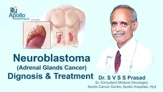 Neuroblastoma  Diagnosis amp Treatment  Dr SVSS Prasad Medical Oncologist  Apollo Hospital [upl. by Hansiain130]