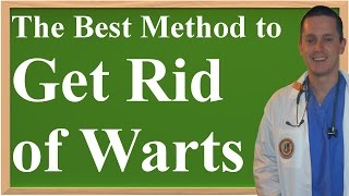 The Best Method to Get Rid of Warts at Home [upl. by Hutton]