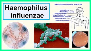 Haemophilus influenzae [upl. by Bandur259]