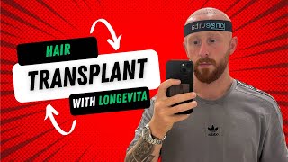 Hair Transplant with Longevita [upl. by Rudelson587]