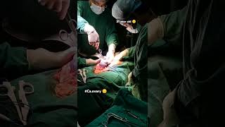 31 year old Interval debulking surgery😔🤲 caovarymedicalstudent doctor viralshort video 🙏🛐 [upl. by Vipul]